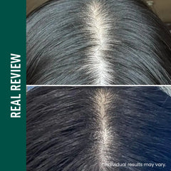 ViveLab Dual Action Power Care Set – Brows, Lashes & Hair Growth