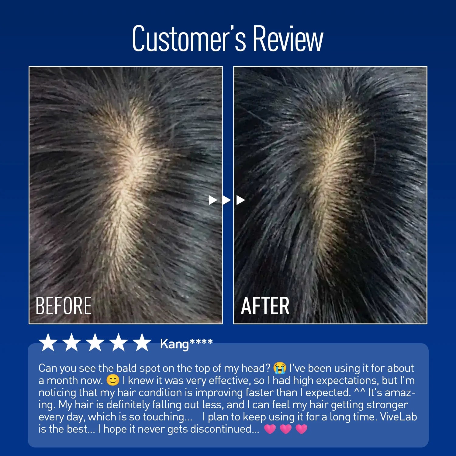 ViveLab Sensitive Scalp Care Set – Nourishing Anti-Hair Loss Duo