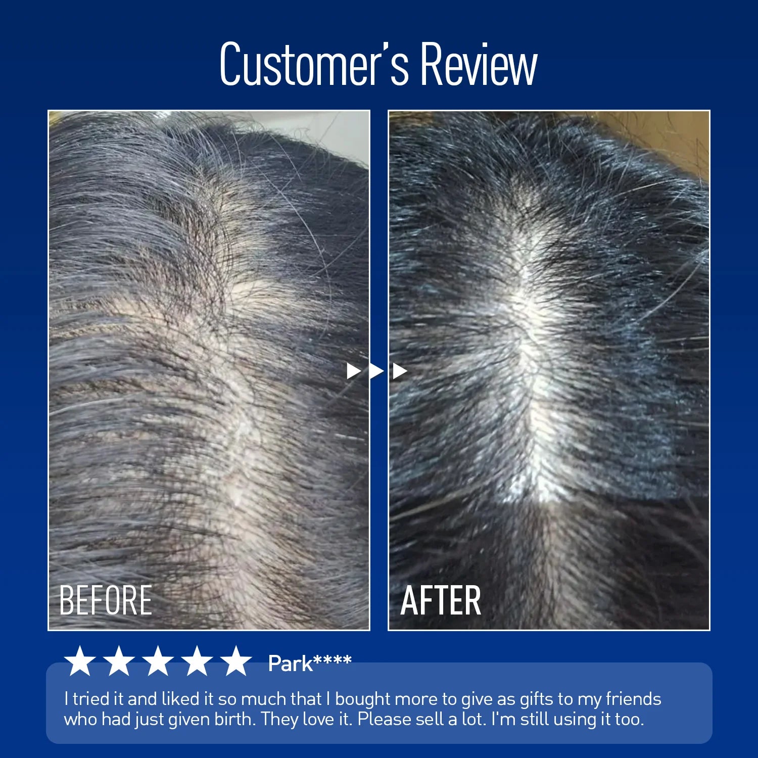 ViveLab Sensitive Scalp Care Set – Nourishing Anti-Hair Loss Duo