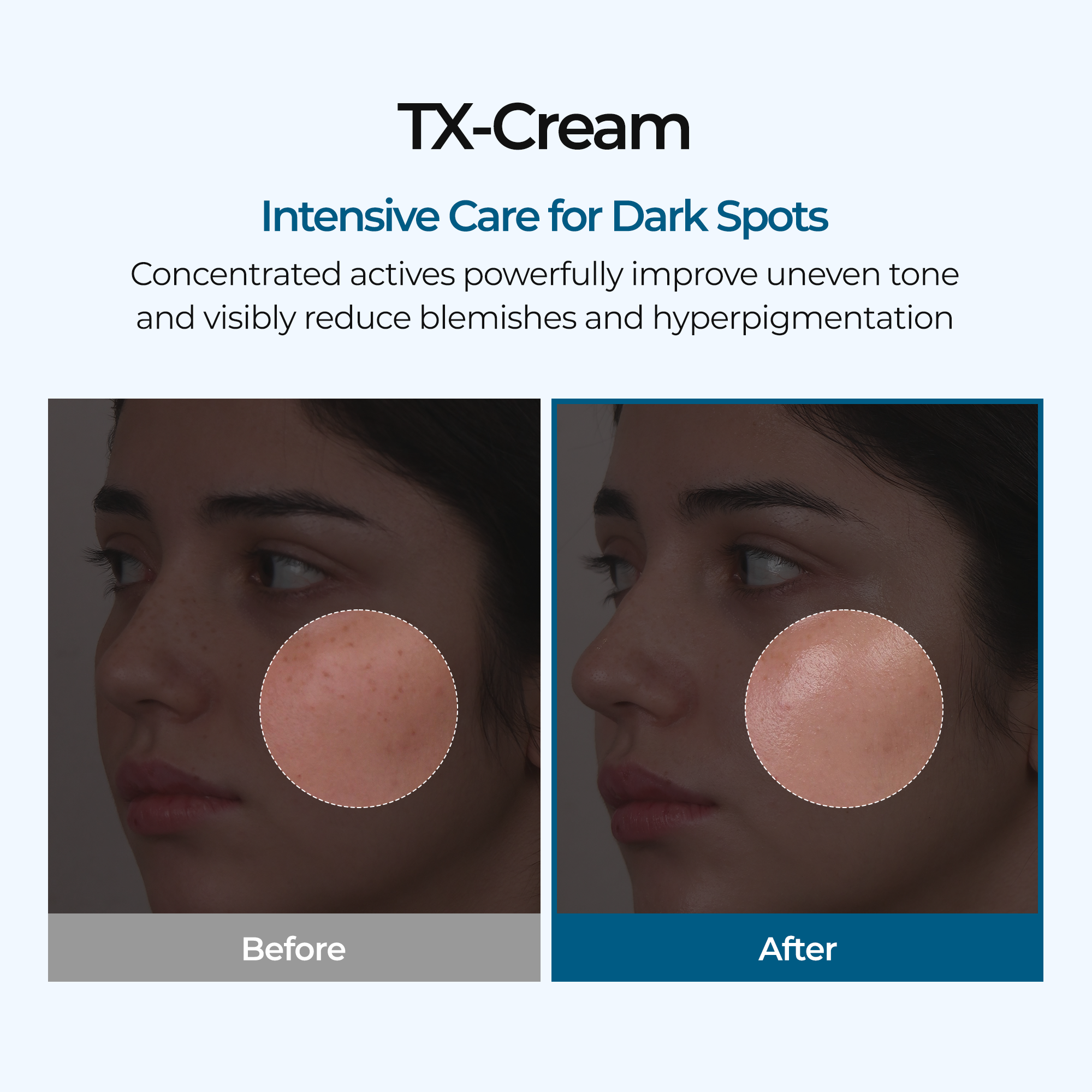Dr.Melaxin TX Cream Tranexamic Acid Dark Spot Moisturizer, 50 ml - Dr.Melaxin K-Beauty view 2