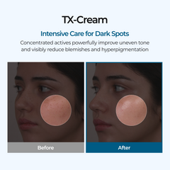 Dr.Melaxin TX Cream Tranexamic Acid Dark Spot Moisturizer, 50 ml - Dr.Melaxin K-Beauty view 2