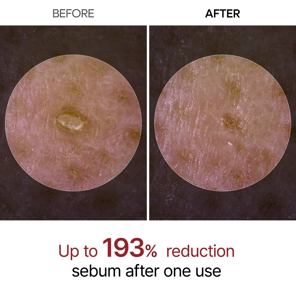 Dr.Melaxin Peel Shot Exfoliating White Rice Ampoule, 80 ml - Dr.Melaxin K-Beauty view 4