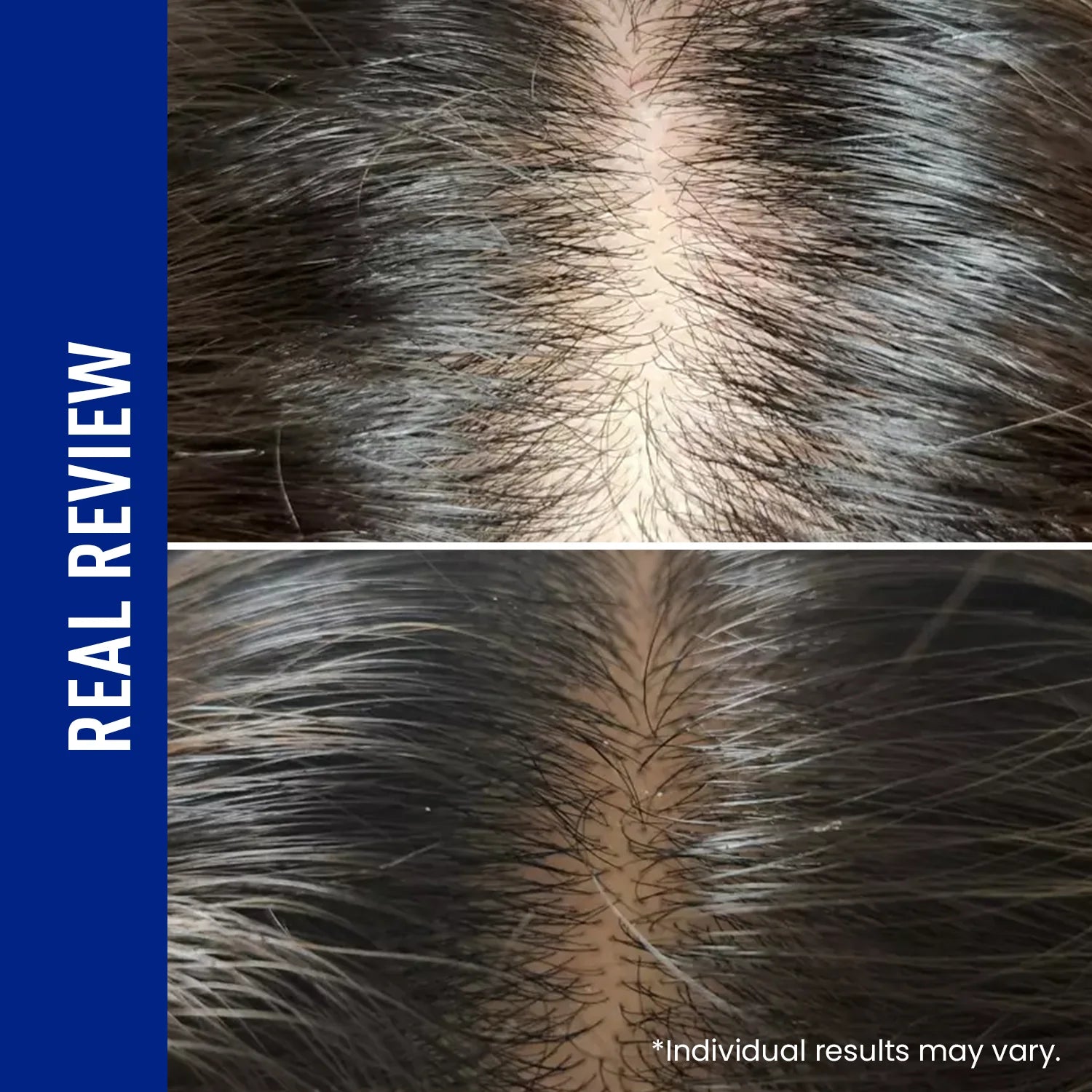 ViveLab Scalp Spioxyl React Shot 400 – Microneedle Hair Serum 15ml