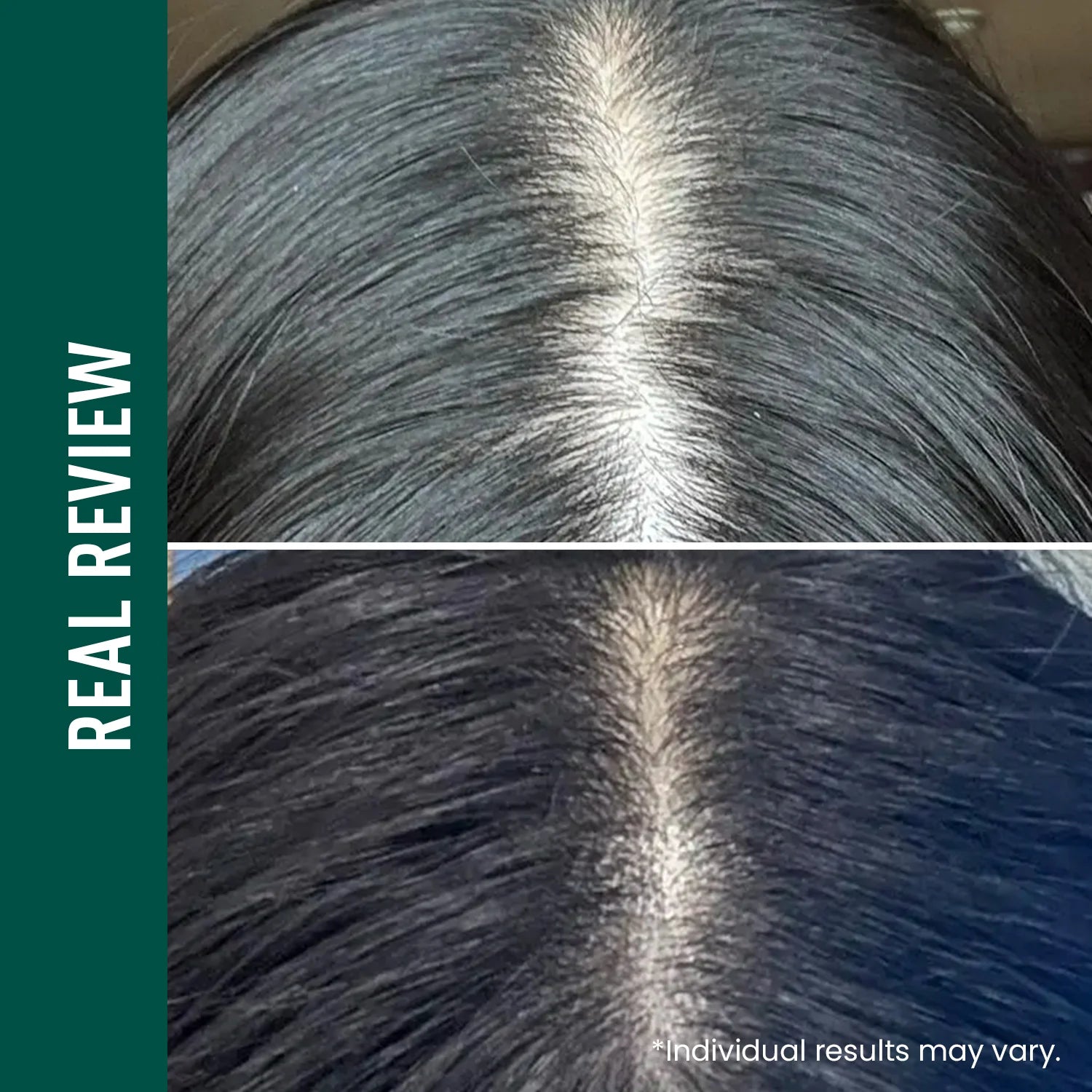 ViveLab Revive Therapy Hair Scalp & Brow Ampoule – Anti-Hair Loss Serum 15ml