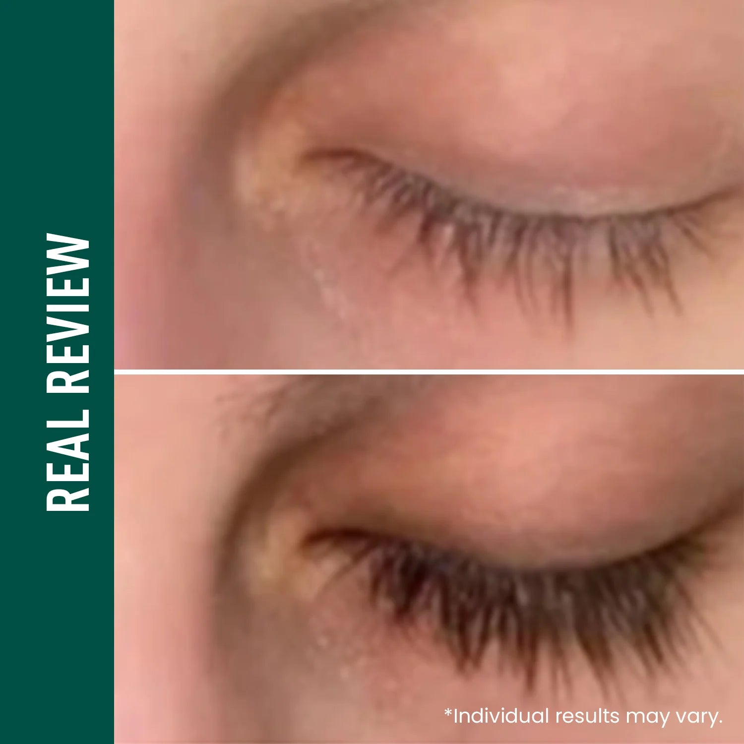 ViveLab Revive Therapy Serum – Lash, Brow & Hairline Growth Booster 10g