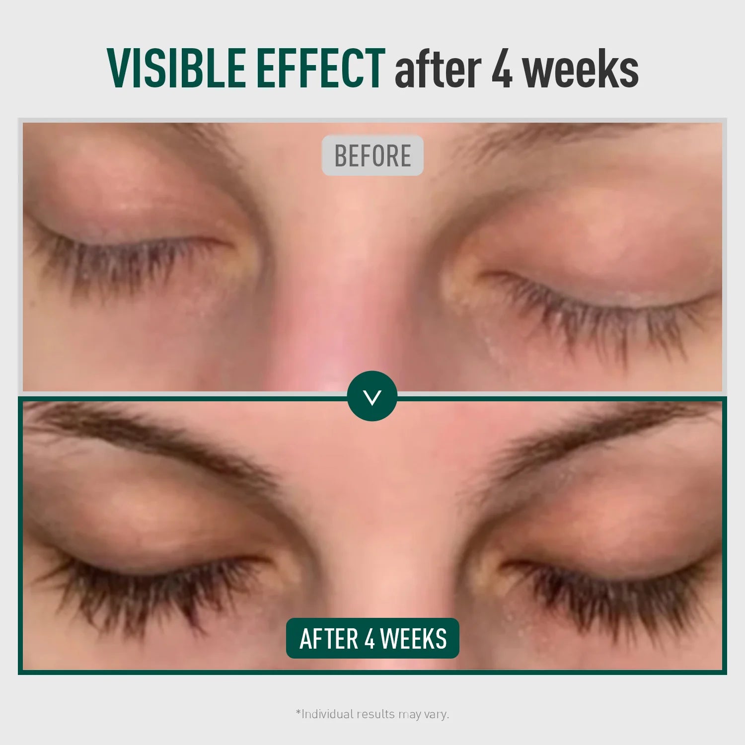 ViveLab Revive Therapy Serum – Lash, Brow & Hairline Growth Booster 10g