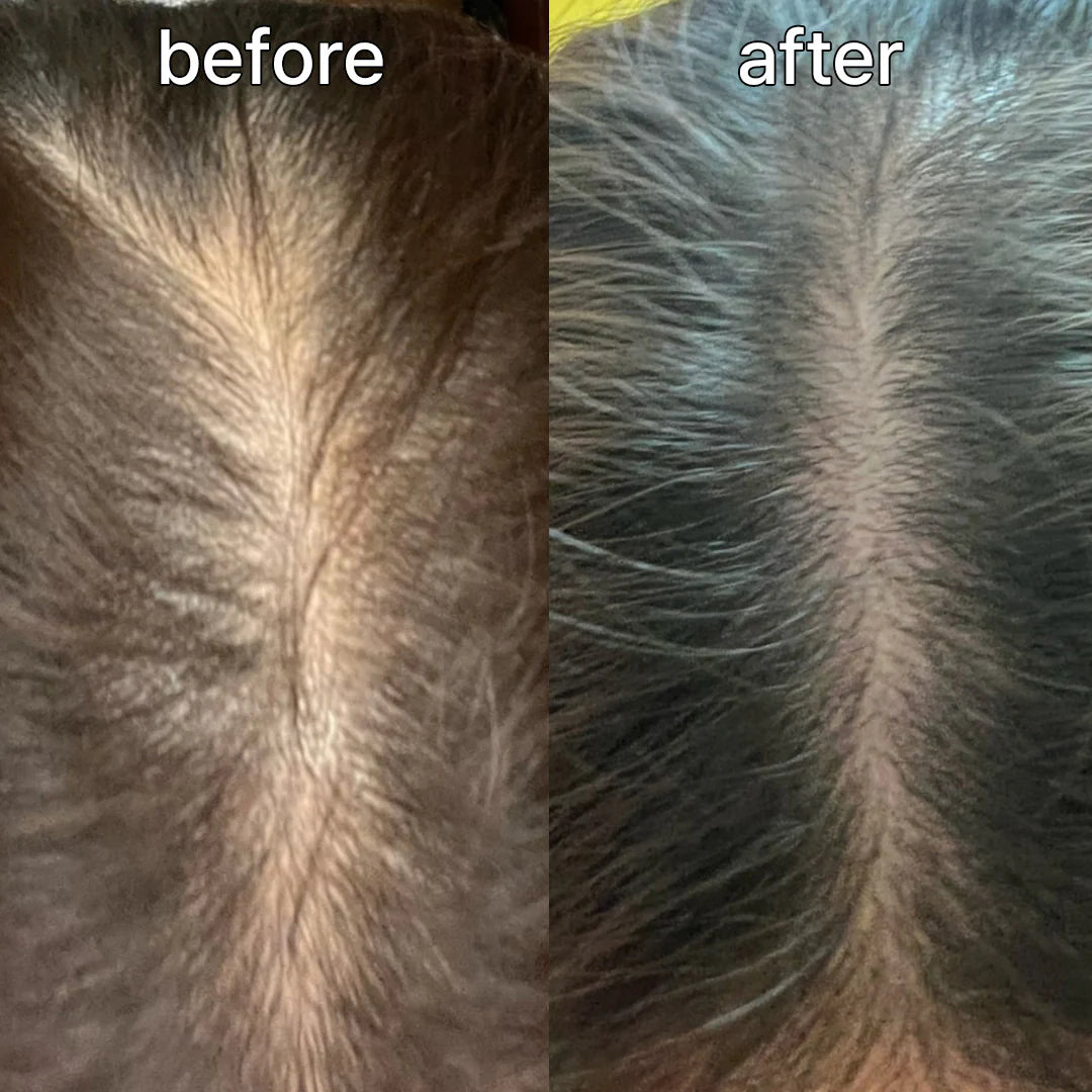 ViveLab Revive Therapy Hair Scalp & Brow Ampoule – Anti-Hair Loss Serum 15ml