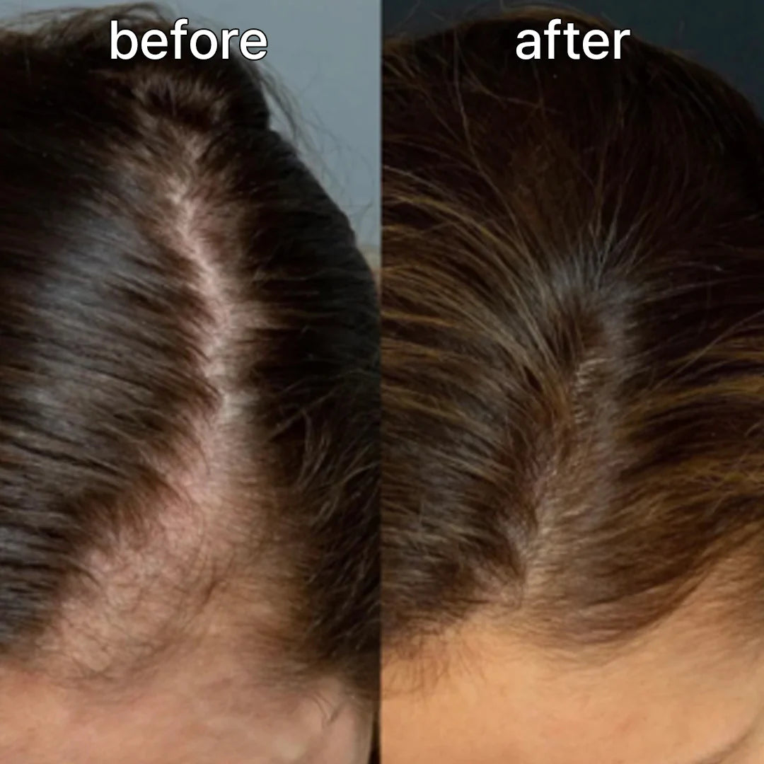 ViveLab Revive Therapy Hair Scalp & Brow Ampoule – Anti-Hair Loss Serum 15ml