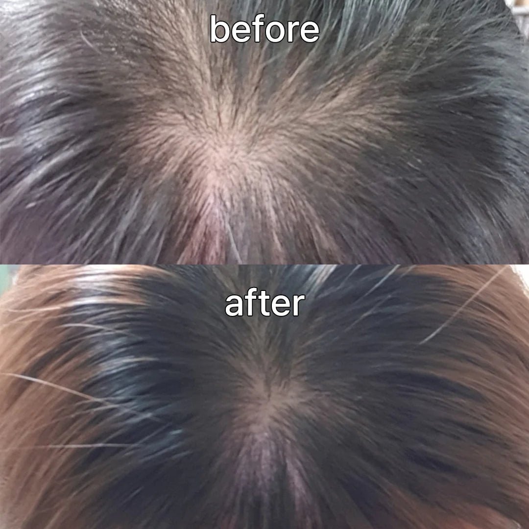 ViveLab Revive Therapy Hair Scalp & Brow Ampoule – Anti-Hair Loss Serum 15ml