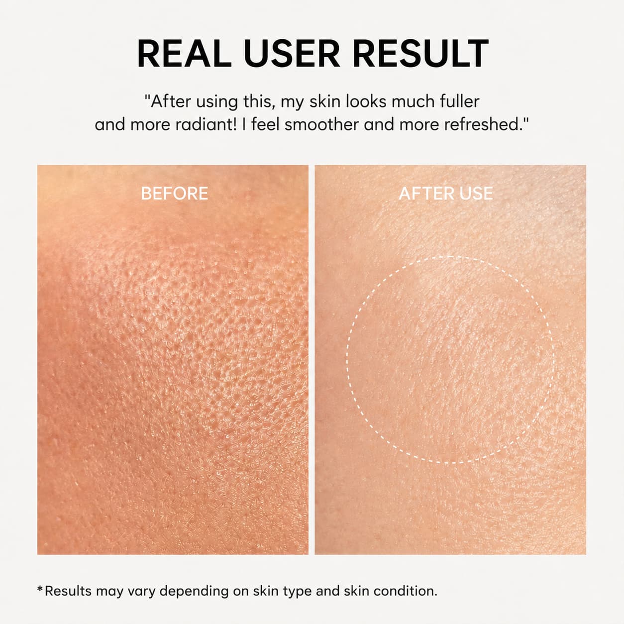 Arencia NAD+ Time-Rewind Booster Shot, Firming Serum, 30 ml