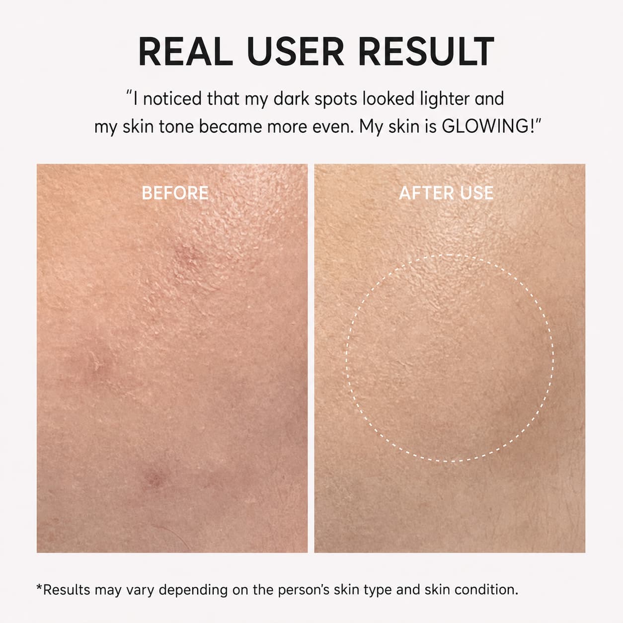 Arencia TXA Booster Shot, Dark Spot Correcting Serum, 30 ml