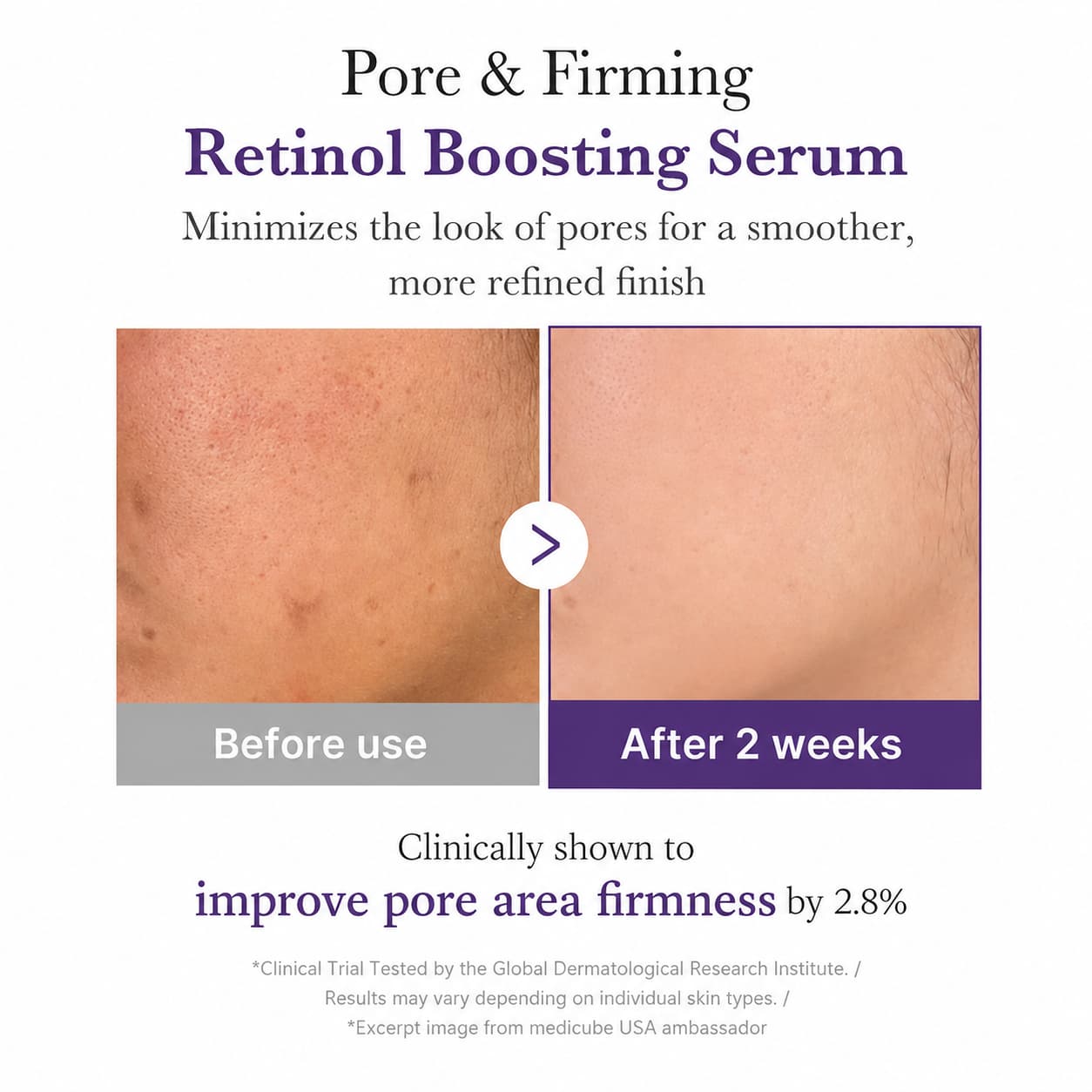 Medicube Retinol 1.9% NMN Boosting Serum, 30 ml