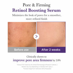 Medicube Retinol 1.9% NMN Boosting Serum, 30 ml