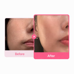 Medicube Ultra Light PDRN Pink Peptide Serum, 30 ml