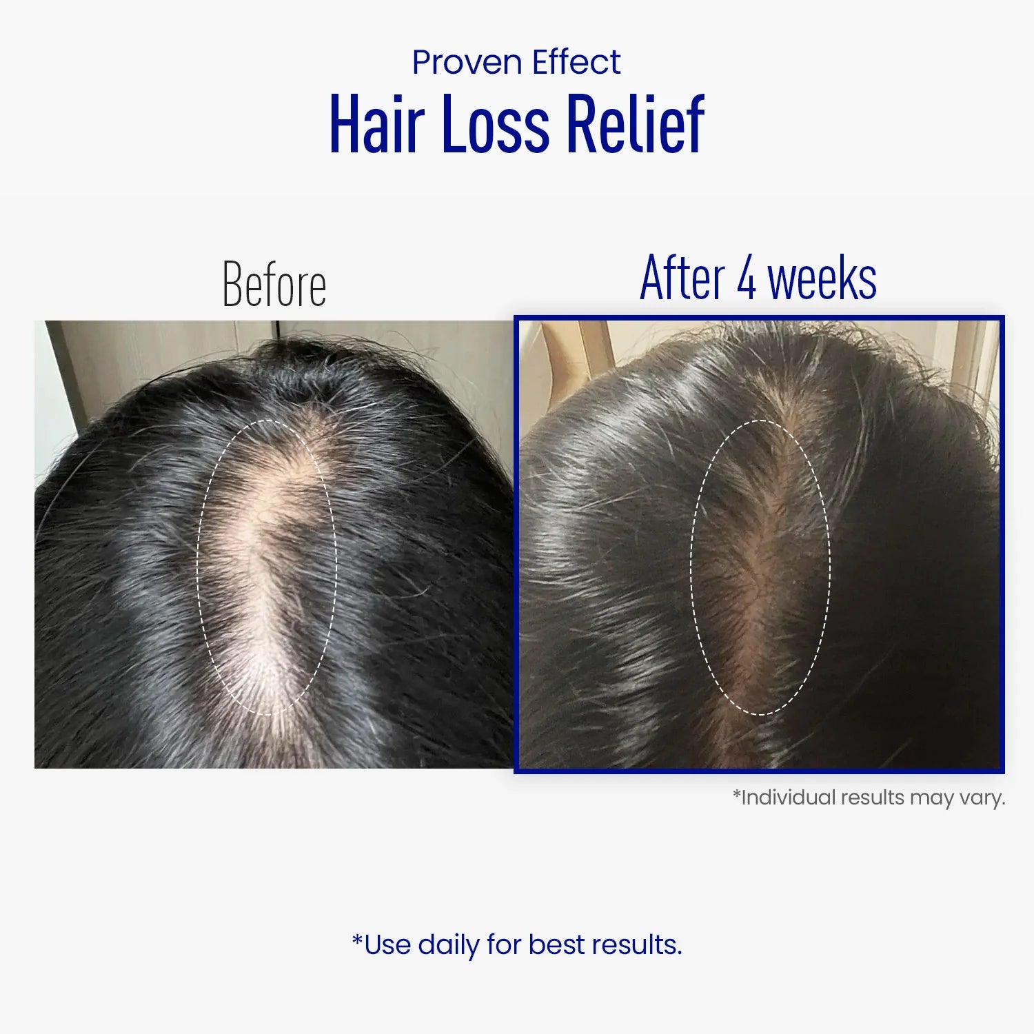 ViveLab Scalp Spioxyl React Shot 400 – Microneedle Hair Serum 15ml