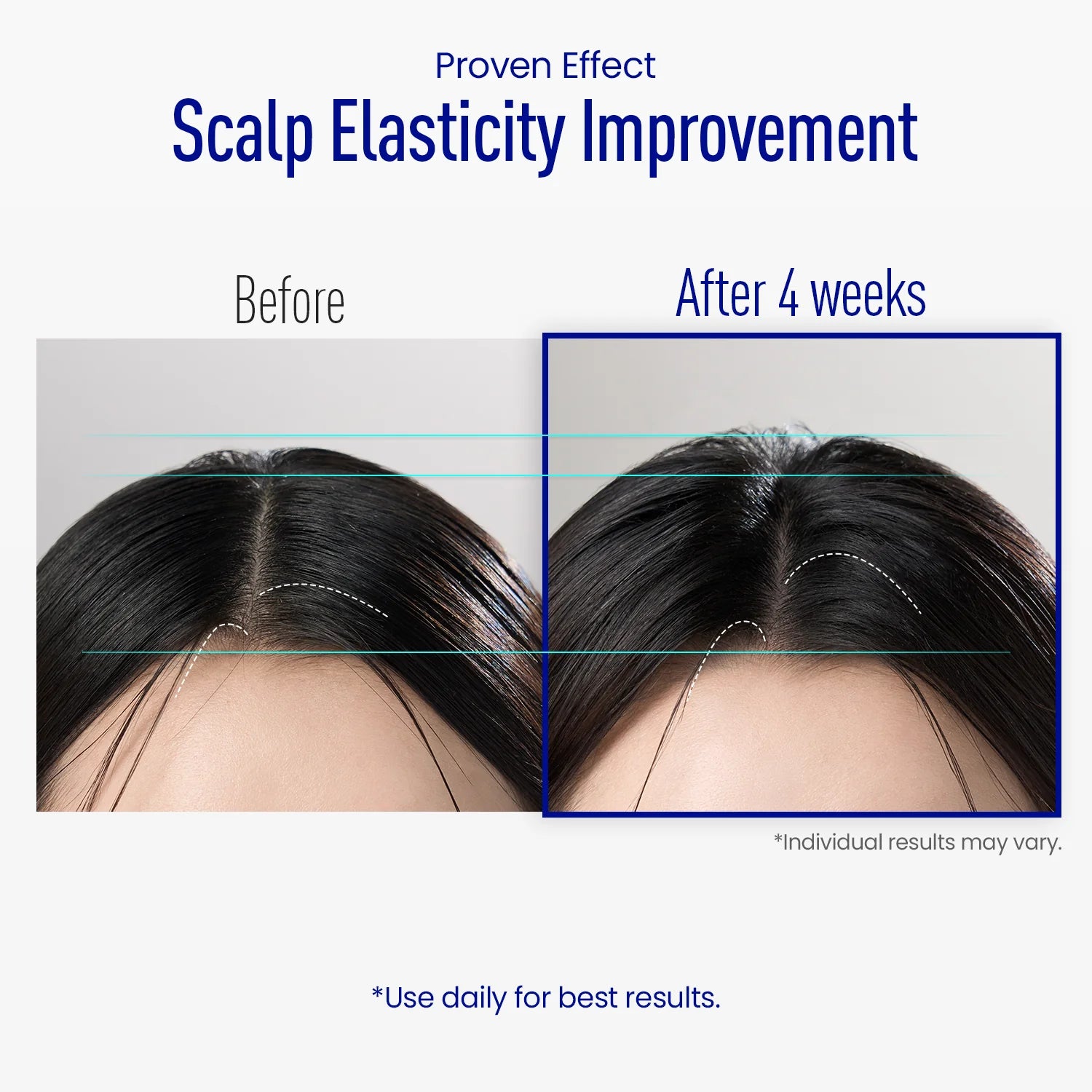 ViveLab Scalp Spioxyl React Shot 400 – Microneedle Hair Serum 15ml