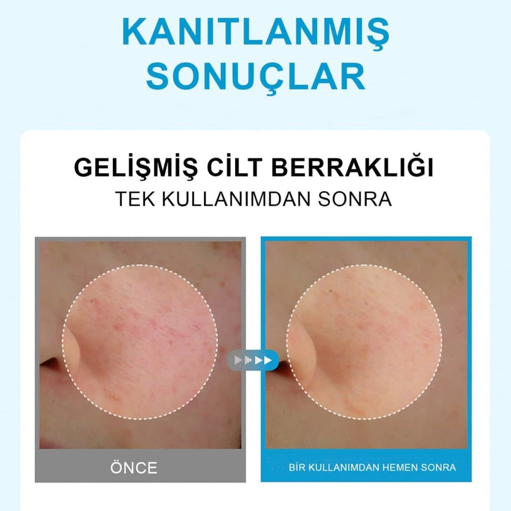 Centellian24 Hyal Waterfull Glow Gel Mask / Hyaluronik Asit İçeren Soğutucu Hidrojel Maske (22mlx5 Adet) - Centellian24 - Vionine