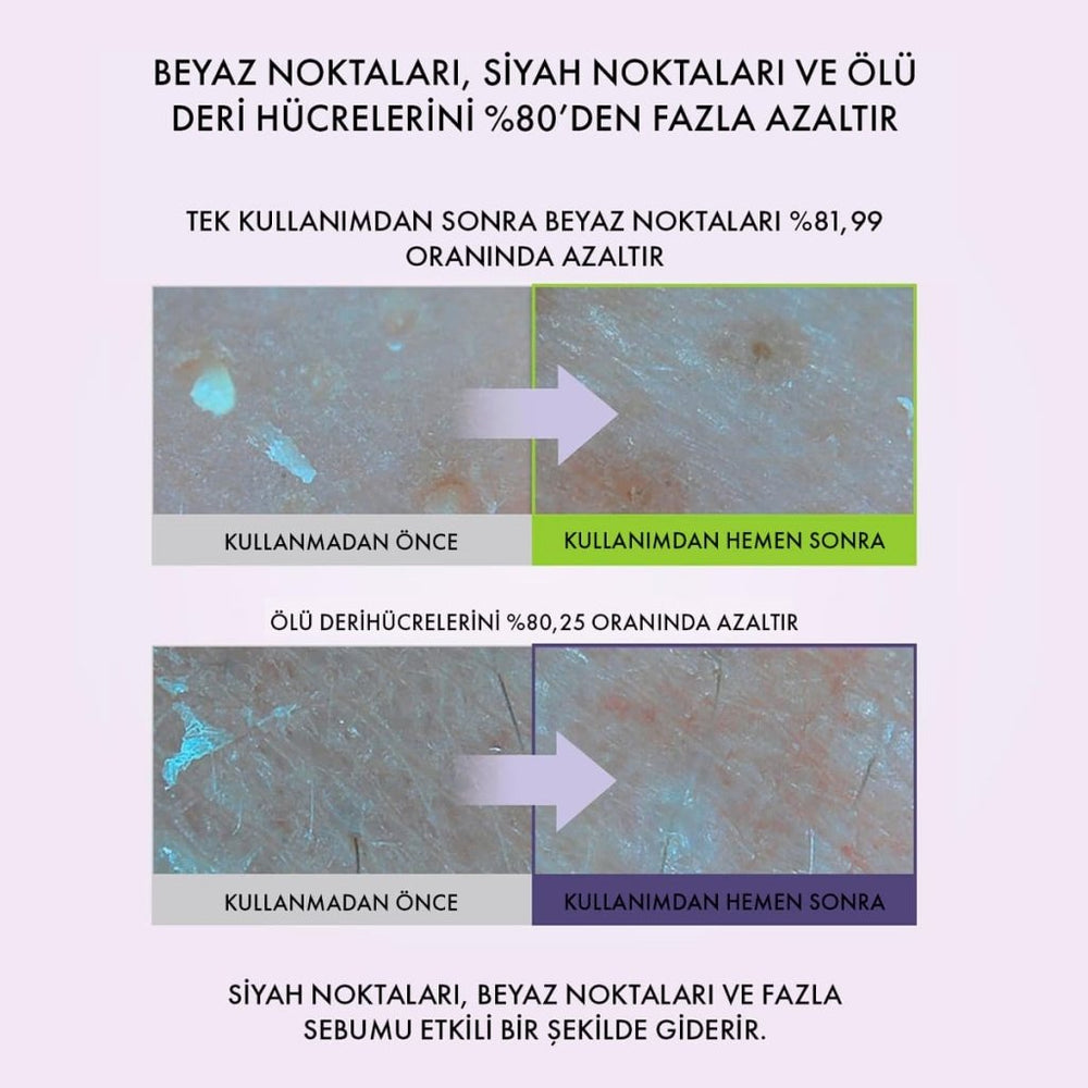 Centellian24 Madeca Real Green Nose Pore Pad / 2 Adımlı Bakım (7ml x 5 Set) - Centellian24 - Vionine