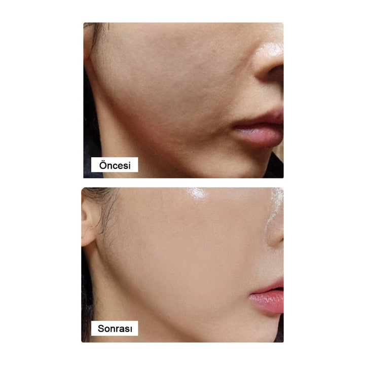 LamuCell PDRN Ampoule / Kırışıklık Karşıtı Bakım Serumu 50ml - LamuCell - Vionine