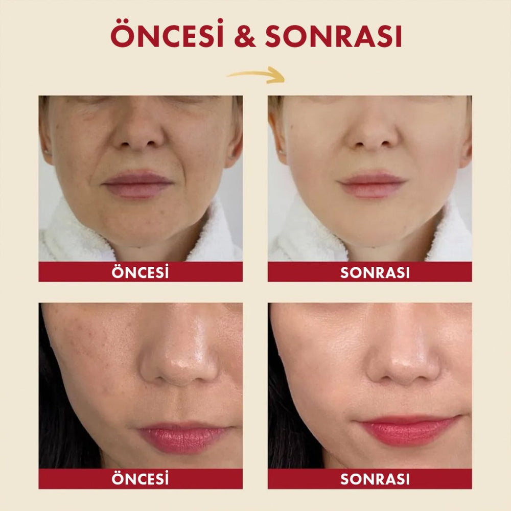 Seoul 1988 Snail Mucin %97 + Rice Essence Onarıcı Salyangoz ve Pirinç Esans - K - SECRET - Vionine