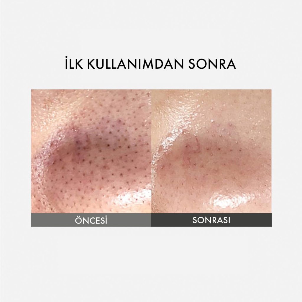 Sungboon Editor Blackhead Melting Clear Pad / Sebum ve Siyah Nokta Temizleyici Burun Bandı - SUNGBOON EDITOR - Vionine