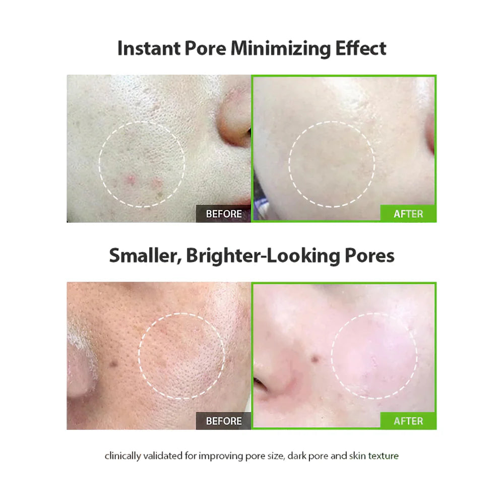 Sungboon Editor Green Tomato Pore Lifting Ampoule Serum 30ml – product photo 6