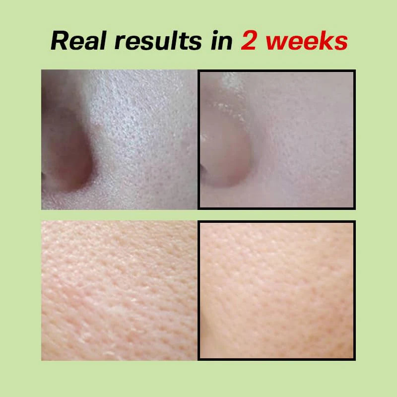Sungboon Editor Green Tomato Pore Lifting Ampoule Serum 30ml – product photo 7