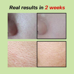 Sungboon Editor Green Tomato Pore Lifting Ampoule 75ml Serum – product photo 4