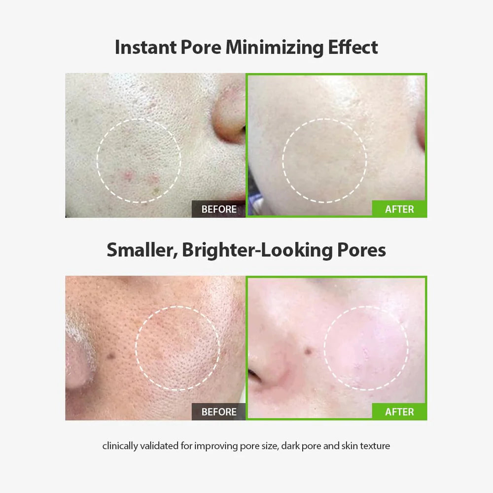Sungboon Editor Green Tomato Pore Lifting Ampoule 75ml Serum – product photo 5