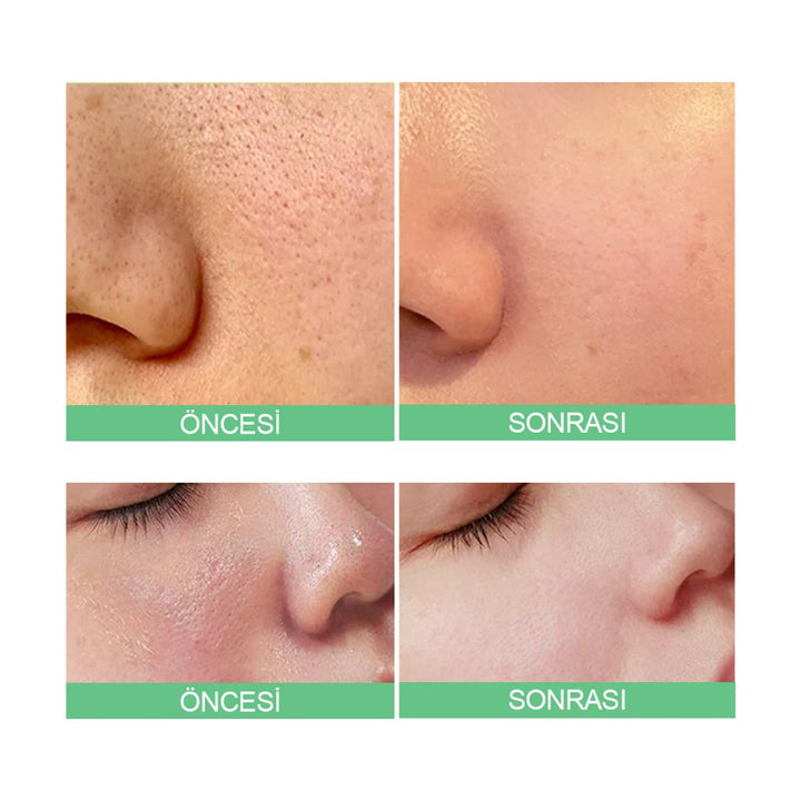 Sungboon Green Tomato Pore Lifting Ampoule 30ml Serum - SUNGBOON EDITOR - Vionine