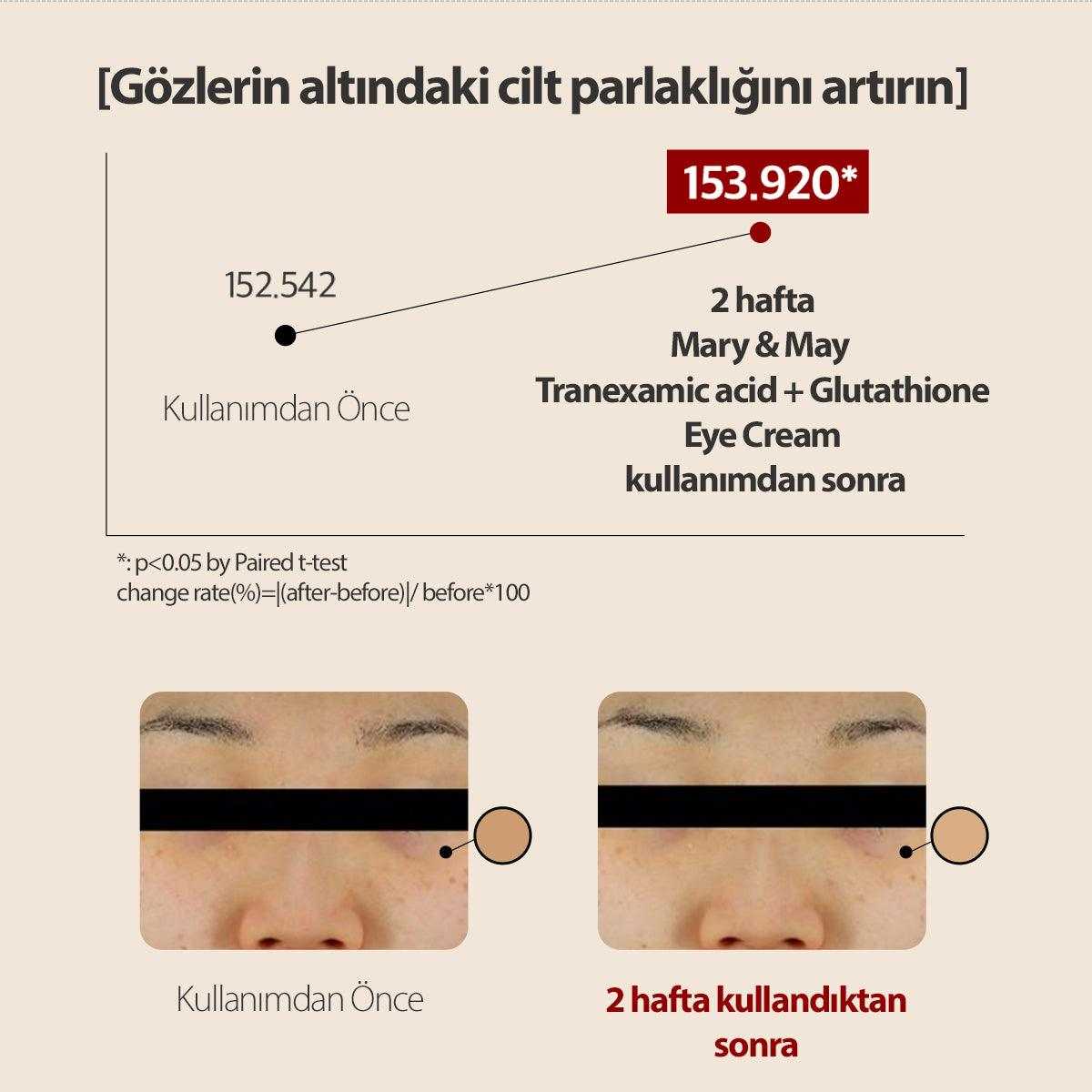 Tranexamic Acid+Glutathion Koyu Halka Karşıtı Aydınlatıcı Göz Çevresi Kremi 30 Gr - Mary & May - Vionine