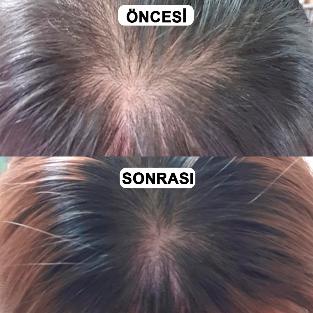ViveLab Revive Therapy Hair Scalp & Brow Ampoule / Saç Derisi ve Kaş Bakım Ampulü - ViveLab - Vionine
