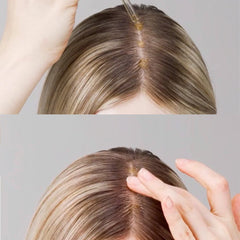 ViveLab Spioxyl Shot 800 – Intensive Scalp Strengthening Ampoule